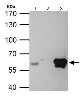 Immunoprecipitation - Anti-ETS2 antibody (AB272866)