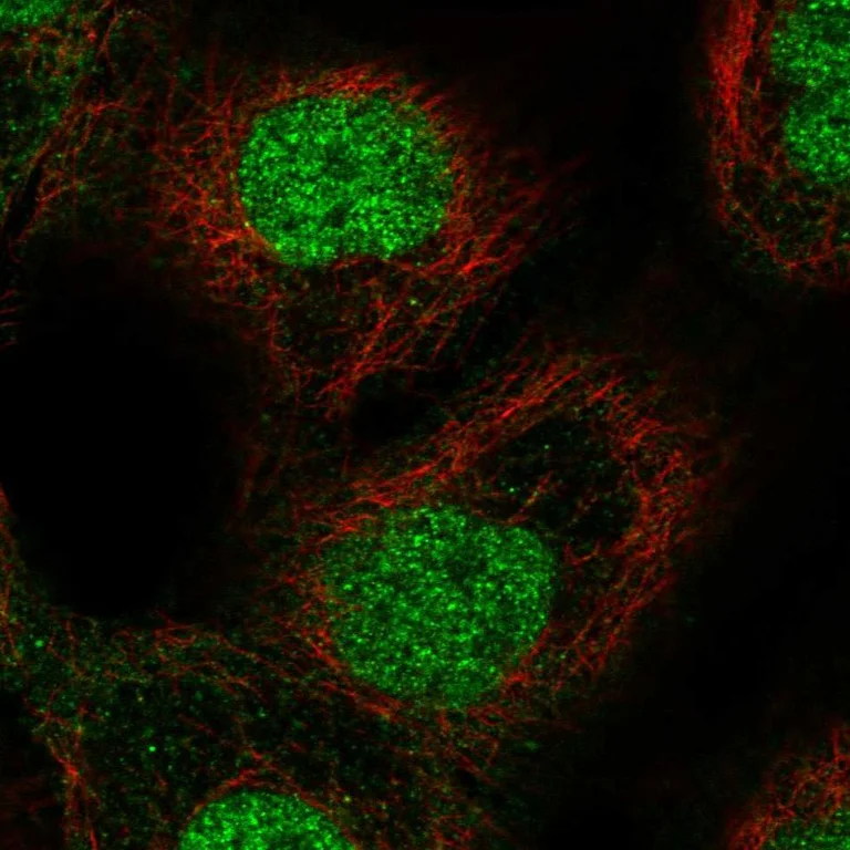 Immunocytochemistry/ Immunofluorescence - Anti-ETS2 Antibody (AB327175)