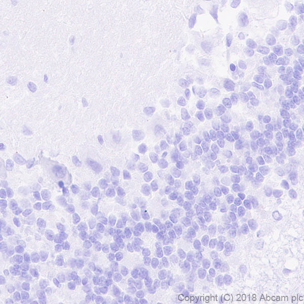 Immunohistochemistry (Formalin/PFA-fixed paraffin-embedded sections) - Anti-ETS2 antibody [EPR22419] (AB219948), expandable thumbnail