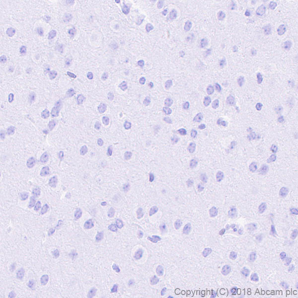 Immunohistochemistry (Formalin/PFA-fixed paraffin-embedded sections) - Anti-ETS2 antibody [EPR22419] - BSA and Azide free (ab243290), expandable thumbnail