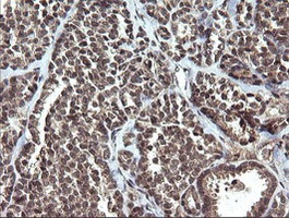 Immunohistochemistry (Formalin/PFA-fixed paraffin-embedded sections) - Anti-ETS2 antibody [OTI1H4] (AB140371), expandable thumbnail