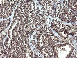 Immunohistochemistry (Formalin/PFA-fixed paraffin-embedded sections) - Anti-ETS2 antibody [OTI1H4] (AB140371)