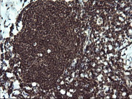 Immunohistochemistry (Formalin/PFA-fixed paraffin-embedded sections) - Anti-ETS2 antibody [OTI1H4] (AB140371), expandable thumbnail