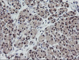 Immunohistochemistry (Formalin/PFA-fixed paraffin-embedded sections) - Anti-ETS2 antibody [OTI1H4] (AB140371), expandable thumbnail