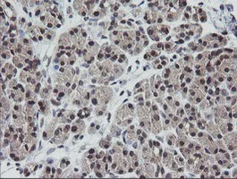 Immunohistochemistry (Formalin/PFA-fixed paraffin-embedded sections) - Anti-ETS2 antibody [OTI1H4] (AB140371)