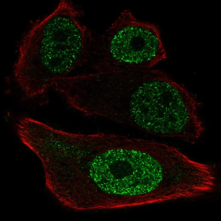 Immunocytochemistry/ Immunofluorescence - Anti-ETV1 Antibody (AB327284)