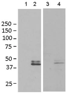 Western blot - Anti-ETV2 antibody [EPR5229(3)] (AB181847)