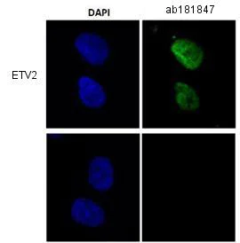 Immunocytochemistry/ Immunofluorescence - Anti-ETV2 antibody [EPR5229(3)] - BSA and Azide free (AB250521)