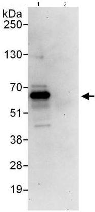Immunoprecipitation - Anti-ETV3 antibody (AB176717)