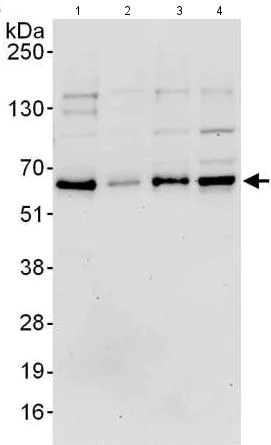Western blot - Anti-ETV3 antibody (AB176717)
