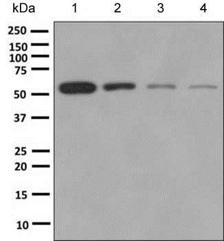 Western blot - Anti-ETV3 antibody [EPR8658] (AB154810), expandable thumbnail