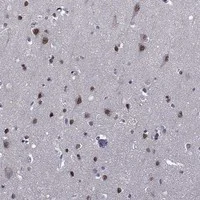 Immunohistochemistry (Formalin/PFA-fixed paraffin-embedded sections) - Anti-ETV5 Antibody (AB327278)