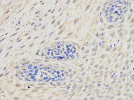 Immunohistochemistry (Formalin/PFA-fixed paraffin-embedded sections) - Anti-ETV6 / Tel antibody (AB185816)
