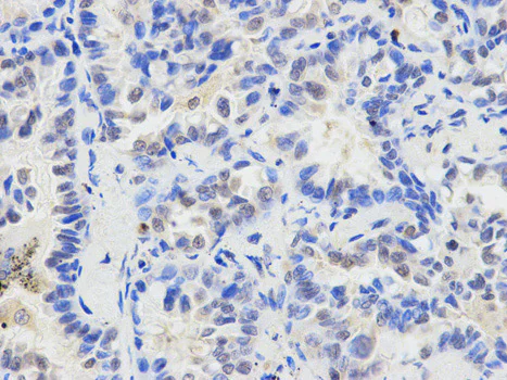 Immunohistochemistry (Formalin/PFA-fixed paraffin-embedded sections) - Anti-ETV6 / Tel antibody (AB185816)
