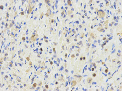 Immunohistochemistry (Formalin/PFA-fixed paraffin-embedded sections) - Anti-ETV6 / Tel antibody (AB185816)