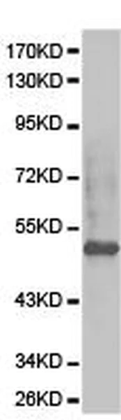 Western blot - Anti-ETV6 / Tel antibody (AB185816)
