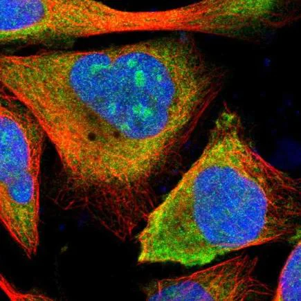 Immunocytochemistry/ Immunofluorescence - Anti-ETV6 / Tel antibody (AB223705)