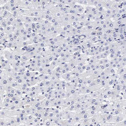 Immunohistochemistry (Formalin/PFA-fixed paraffin-embedded sections) - Anti-ETV6 / Tel antibody (AB223705)