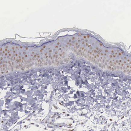 Immunohistochemistry (Formalin/PFA-fixed paraffin-embedded sections) - Anti-ETV6 / Tel antibody (AB223705)