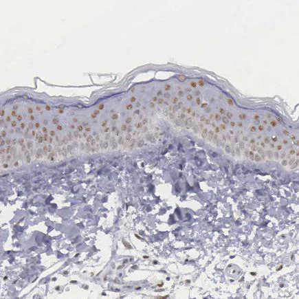 Immunohistochemistry (Formalin/PFA-fixed paraffin-embedded sections) - Anti-ETV6 / Tel antibody (AB223705)