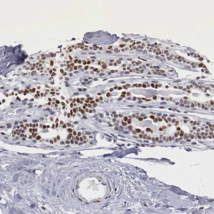 Immunohistochemistry (Formalin/PFA-fixed paraffin-embedded sections) - Anti-ETV6 / Tel antibody (AB223705)
