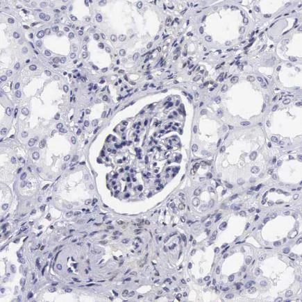 Immunohistochemistry (Formalin/PFA-fixed paraffin-embedded sections) - Anti-ETV6 / Tel antibody (AB223705)