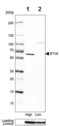 Western blot - Anti-ETV6 / Tel antibody (AB223705)