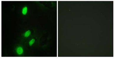 Immunocytochemistry/ Immunofluorescence - Anti-ETV6 / Tel antibody (AB64909)