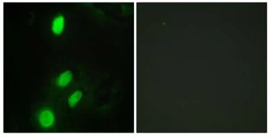 Immunocytochemistry/ Immunofluorescence - Anti-ETV6 / Tel antibody (AB64909)