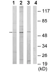 Western blot - Anti-ETV6 / Tel antibody (AB64909)