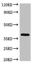 Western blot - Anti-ETV7 antibody (AB229832)