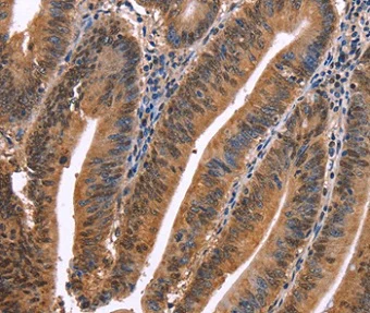 Immunohistochemistry (Formalin/PFA-fixed paraffin-embedded sections) - Anti-EVC2 antibody (AB198930)