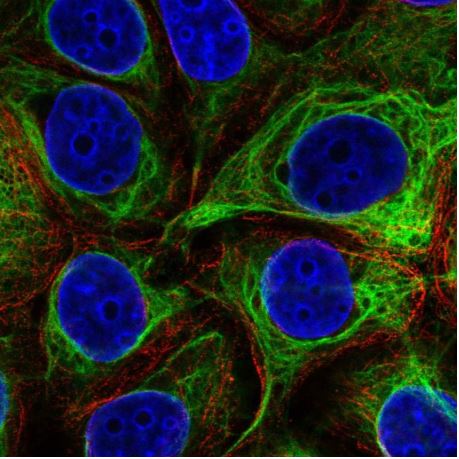 Immunocytochemistry/ Immunofluorescence - Anti-EVPL antibody (AB204237), expandable thumbnail