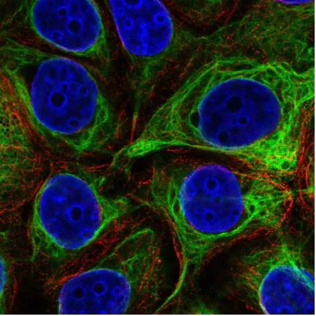 Immunocytochemistry/ Immunofluorescence - Anti-EVPL antibody (AB204237)