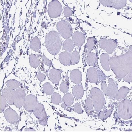 Immunohistochemistry (Formalin/PFA-fixed paraffin-embedded sections) - Anti-EVPL antibody (AB204237), expandable thumbnail