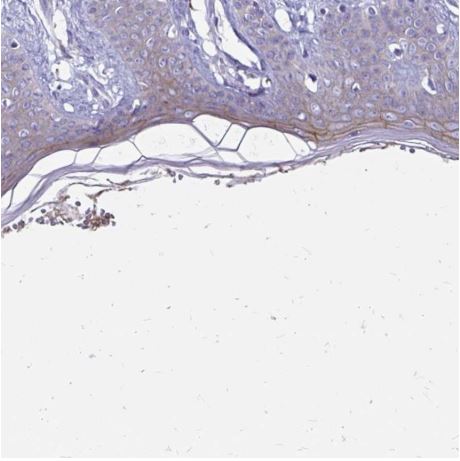 Immunohistochemistry (Formalin/PFA-fixed paraffin-embedded sections) - Anti-EVPL antibody (AB204237), expandable thumbnail