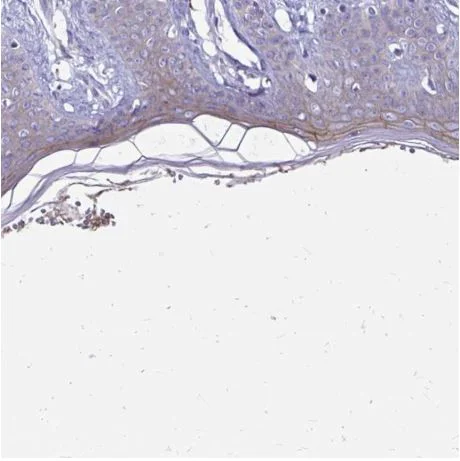 Immunohistochemistry (Formalin/PFA-fixed paraffin-embedded sections) - Anti-EVPL antibody (AB204237)
