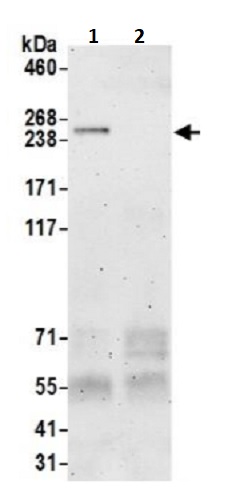 Immunoprecipitation - Anti-EVPL antibody (AB242119)