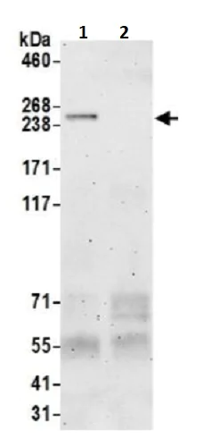 Immunoprecipitation - Anti-EVPL antibody (AB242119)