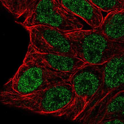 Immunocytochemistry/ Immunofluorescence - Anti-Evx1 antibody (AB220665)