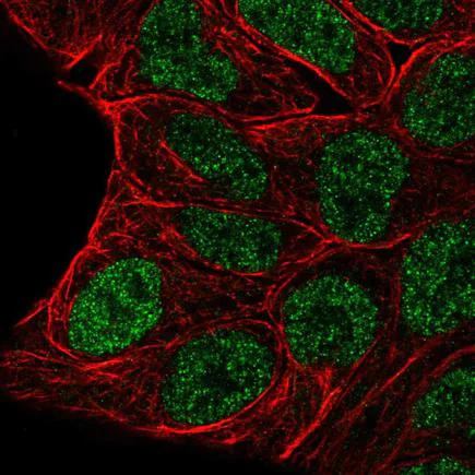 Immunocytochemistry/ Immunofluorescence - Anti-Evx1 antibody (AB220665)