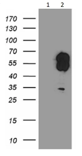 Western blot - Anti-Evx1 antibody [OTI1F8] (AB236382)