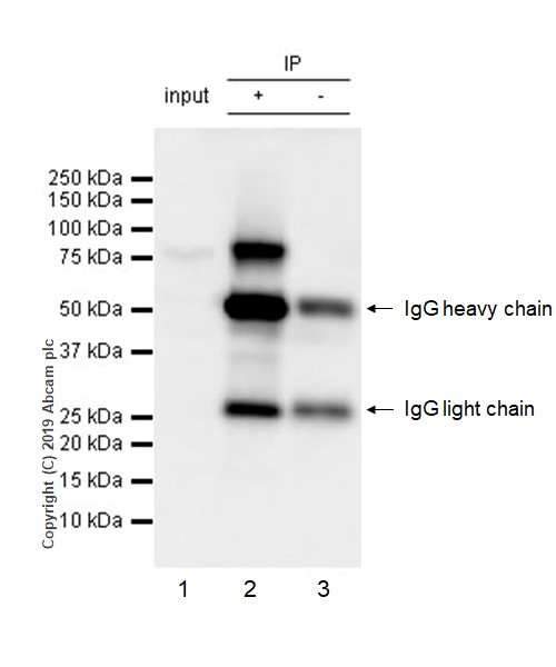 Immunoprecipitation - Anti-EWSR1/EWS antibody [21B1] (AB252829)