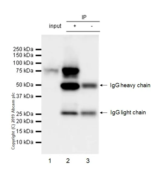 Immunoprecipitation - Anti-EWSR1/EWS antibody [21B1] (AB252829)