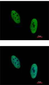 Immunocytochemistry/ Immunofluorescence - Anti-EWSR1/EWS antibody (AB153719)