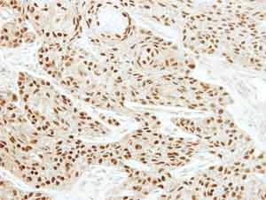 Immunohistochemistry (Formalin/PFA-fixed paraffin-embedded sections) - Anti-EWSR1/EWS antibody (AB153719)