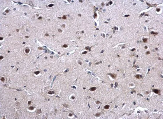 Immunohistochemistry (Formalin/PFA-fixed paraffin-embedded sections) - Anti-EWSR1/EWS antibody (AB153719)
