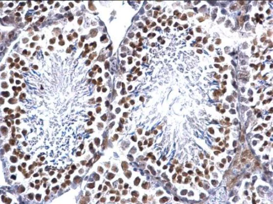 Immunohistochemistry (Formalin/PFA-fixed paraffin-embedded sections) - Anti-EWSR1/EWS antibody (AB153719)