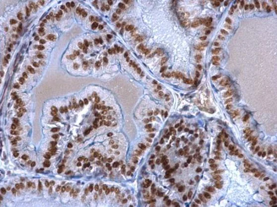 Immunohistochemistry (Formalin/PFA-fixed paraffin-embedded sections) - Anti-EWSR1/EWS antibody (AB153719)