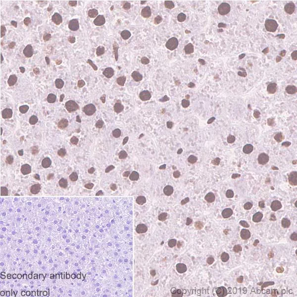 Immunohistochemistry (Formalin/PFA-fixed paraffin-embedded sections) - Anti-EWSR1/EWS antibody [EPR4647] (AB133288)